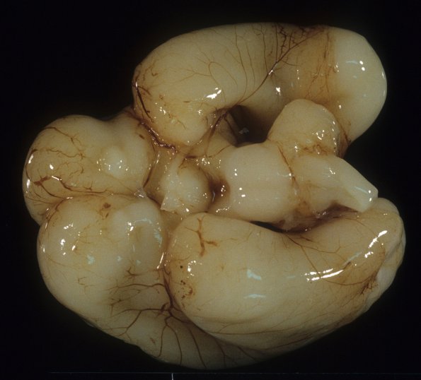 10A2 Normal Fetal Brain 21 wk (Case 10) 2