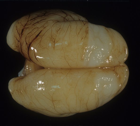 10A3 Normal Fetal Brain 21 wk (Case 10) 3