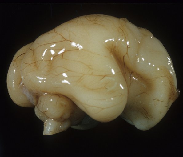 11A1 Normal Fetal Brain 22 wk (Case 11) 1