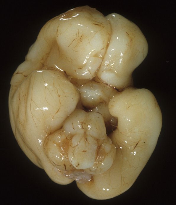 11A3 Normal Fetal Brain 22 wk (A41766) 3