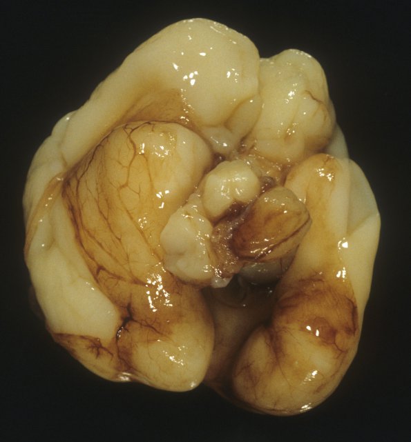 14A2 Normal Fetal Brain, 23wk (Case 14) 2