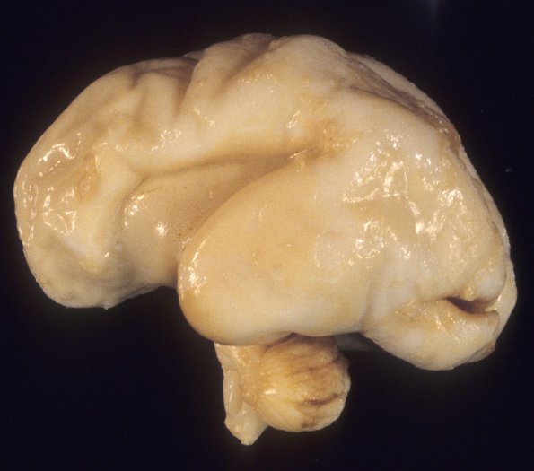 15A1 Normal Fetal Brain 24 wk (Case 15) 2