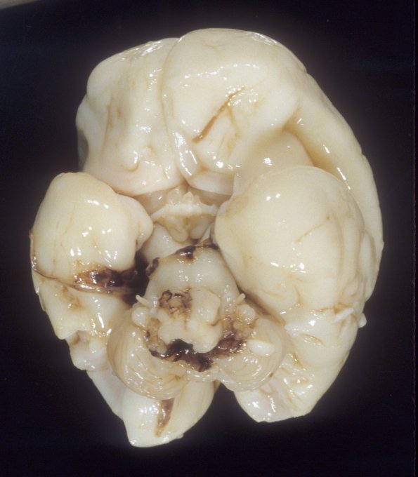 16A2 Normal Fetal Brain 24 wk (Case 16) 1