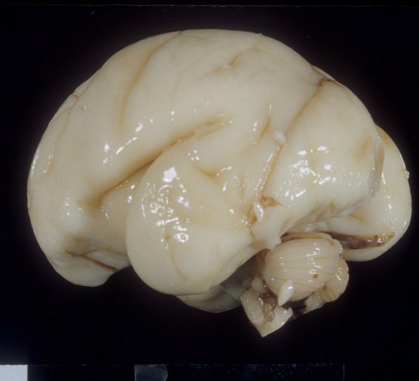 16A4 Normal Fetal Brain 24 wk (Case 16) 3