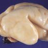 17B Brain, normal, fetus 24 weeks