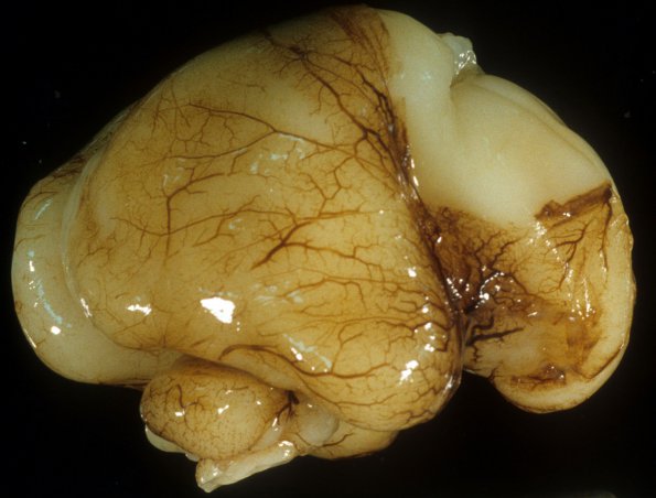 1A2 Normal Fetal Brain 19 wk (Case 1) 2