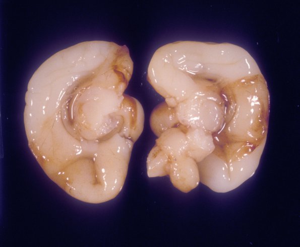 2 Normal Fetal Brain 19 weeks (Case 2) 1