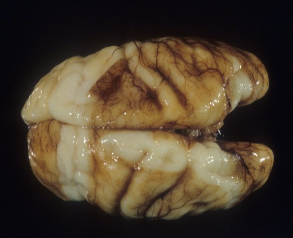 21A2 Normal Fetal Brain 27 wk (Case 21) 2