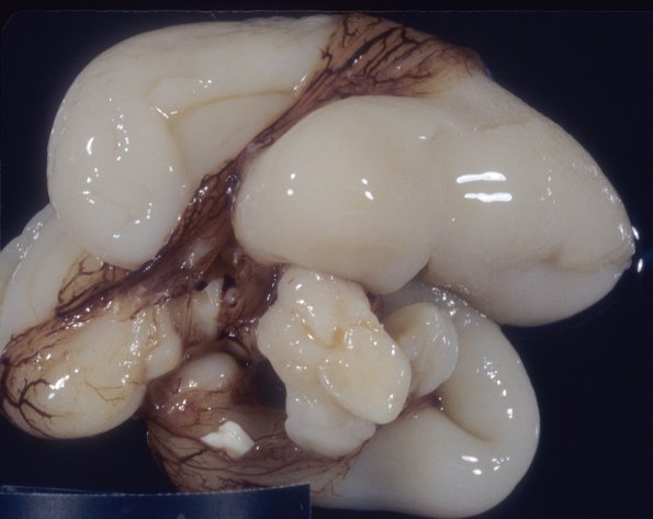 4A2 Normal Fetal Brain 20 wk (Case 4) 1