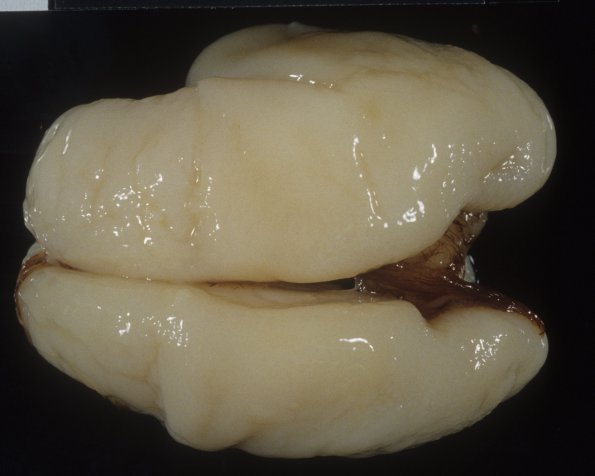 9A3 Normal Fetal Brain 21 wk (Case 9) 3