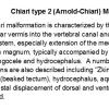 0 Chiari type 2 (Arnold-Chiari) Malformation