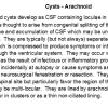 0A Cyst - Arachnoid 