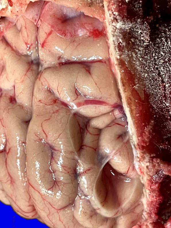 12A2 African painted dog