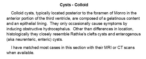 0A Cysts - Colloid A