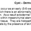 0A Cyst - Dermoid text