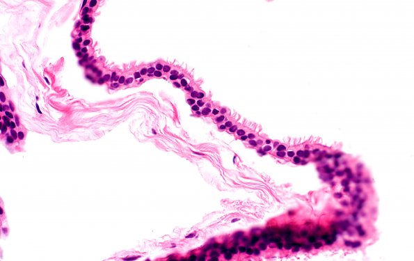 10B3 Cyst, Neurenteric (Case 10) H&E 20X 2