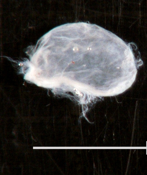 2A Cyst, neurenteric (Case 2) Gross