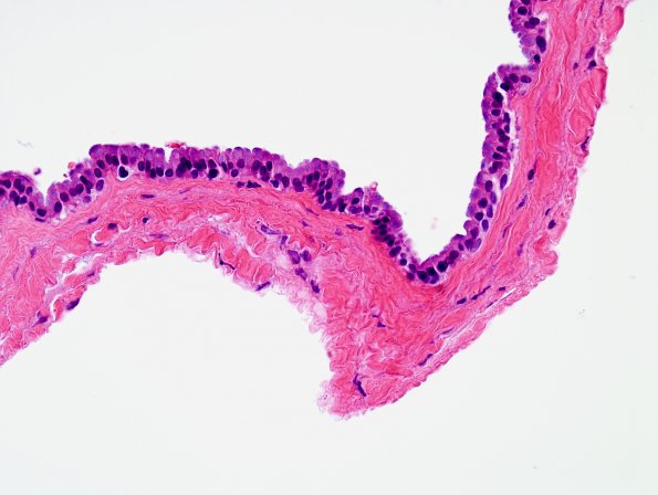 7B2 Cyst, neurenteric (Case 7) H&E 2