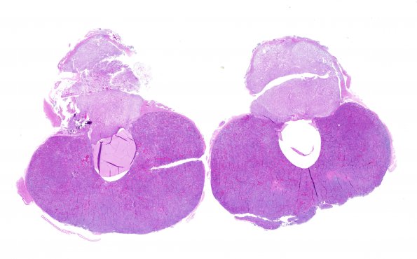 10B1 Rathke's cyst (A19-3) H&E H&E 1