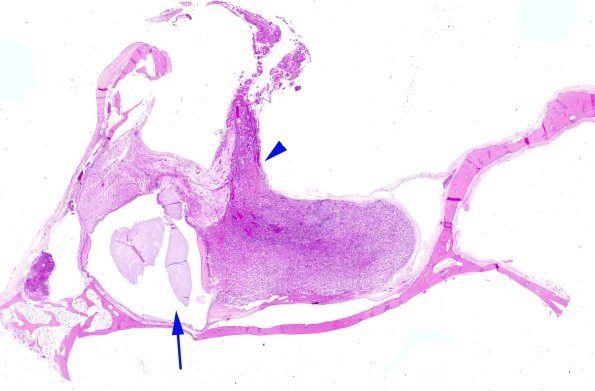 14A Pituitary, normal H&E whole mount copy