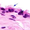 5B3 Cyst, Rathke's Cleft (Case 5) H&E 1