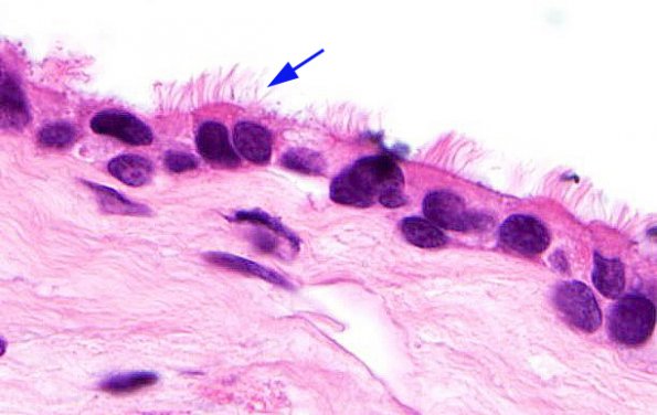 5B3 Cyst, Rathke's Cleft (Case 5) H&E 1