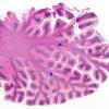 2C1 Hypoxia-Ischemia (Case 2) H&E whole mount