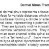 0A Dermal Sinus Tract - text