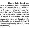 0A Empty Sella Syndrome - Text