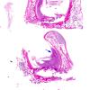 1C1 Empty Sella Syndrome (Case 1) H&E whole mount (2) copy