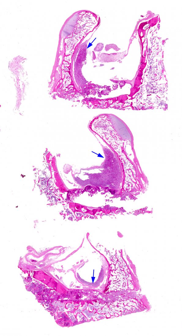 1C1 Empty Sella Syndrome (Case 1) H&E whole mount (2) copy