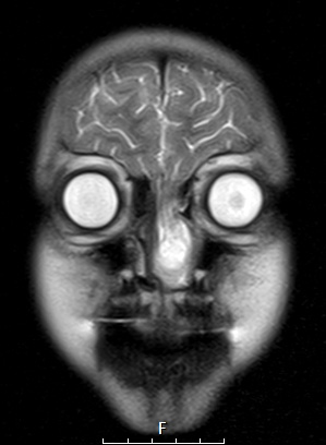 6A4 T2 Haste CORNoC (Case 6)