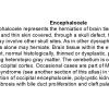 0A Encephalocele - Text