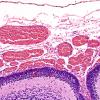 14C3-Encephalocele-Case-14-H-E-2.jpg