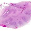 17B2 Polymicrogyria (Case 17) H&E whole mount