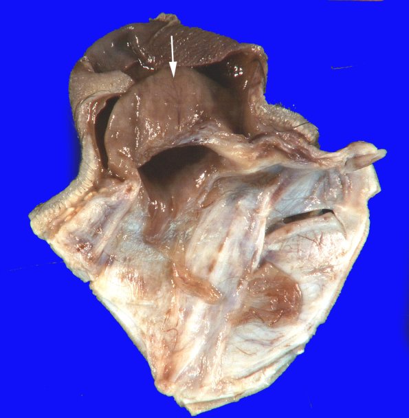 30A6 (Case 30) _8 copy