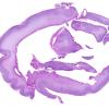 8C1 Encephalocoele (Case 8) whole mount H&E