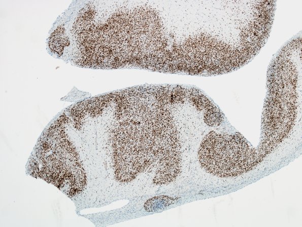 8D2 Encephalocoele (Case 8) NeuN 1