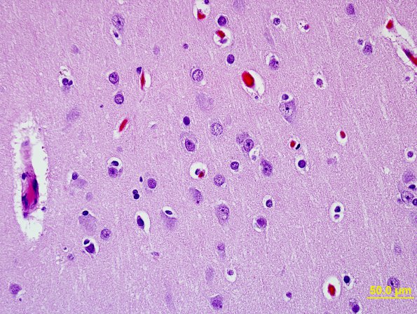 6B4 Control Cortex (Case 7) 40X Scale