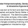 0A Complex Holoprosencephaly Malformation