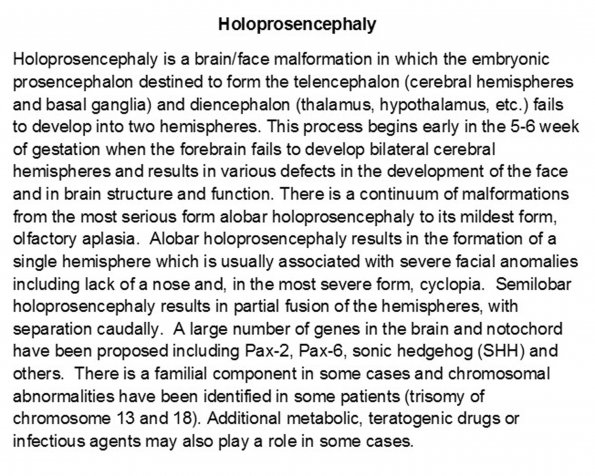 0A Holoprosencephaly Introduction A1