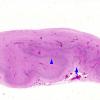 15D2 Holoprosencephaly (Case 15) B H&E whole mount