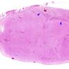 15E2 Holoprosencephaly (Case 15) F H&E whole mount