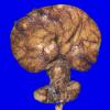 2A3 Holoprosencephaly (Case 2) untouched grossAA