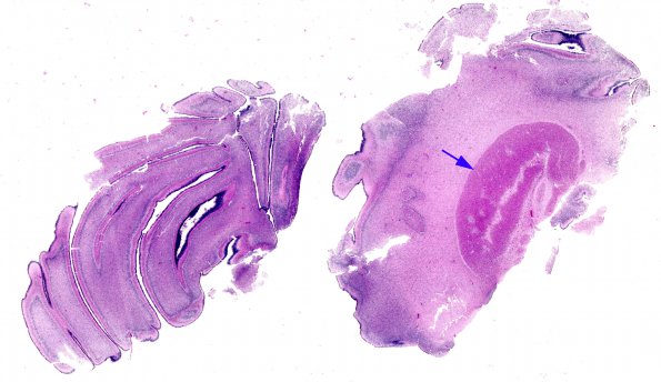 4C2 Holoprosencephaly (Case 4) N7A H&E whole mount