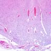 12E3 Holoprosencephaly (Case 12) N8 H&E 1