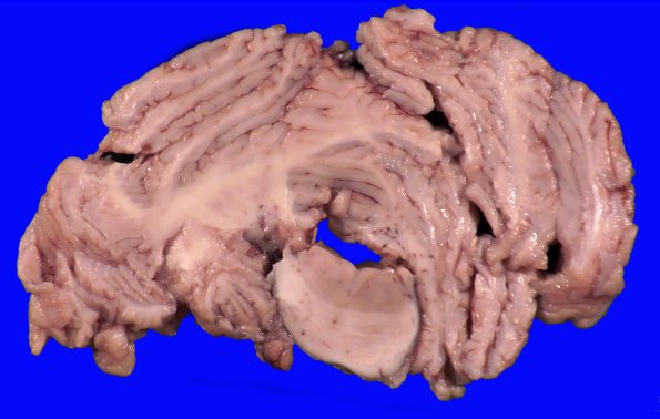 13B8 (Case 13).A.024