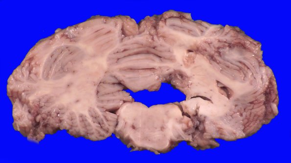 13B9A (Case 13).A.027