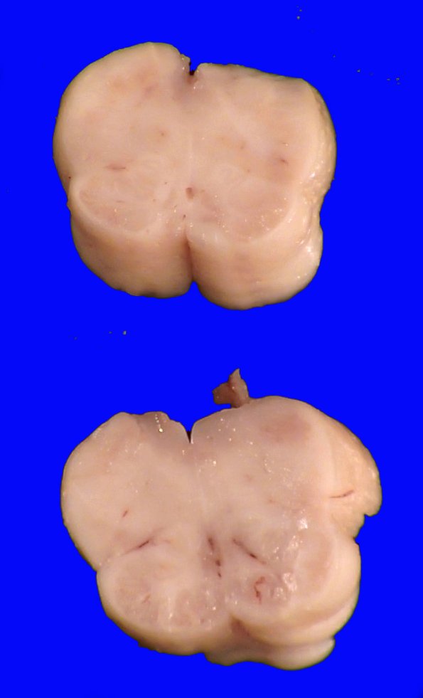 13B9C (Case 13).A.032
