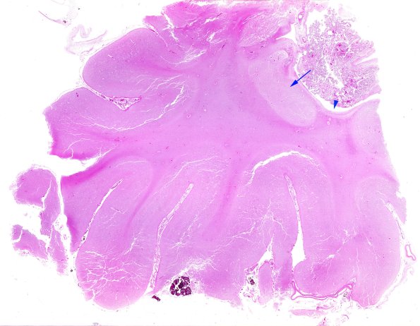 13C0 (Case 13)